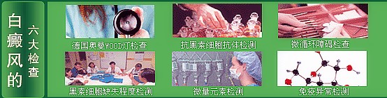 白癜风的六大检查_副本.jpg